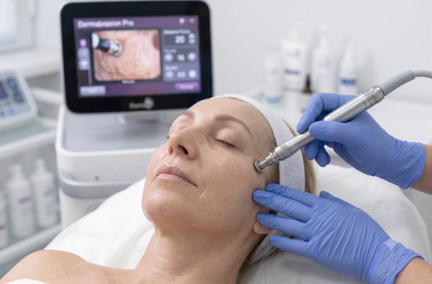 Dermabrasion