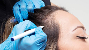 Graft Extraction